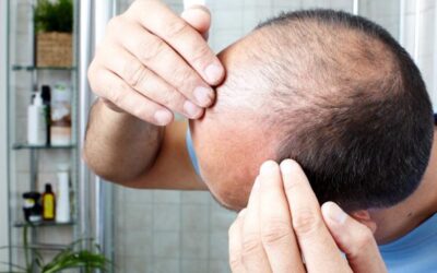 L’efficacia dei rimedi naturali per contrastare la calvizie: i risultati di un recente studio